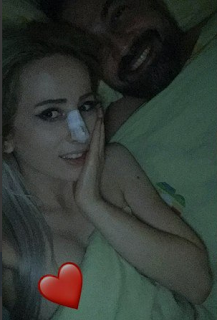 Samsunlu Yeliz Burnunu Yaptırdığı Estetik Doktoruyla Yılın İfşa Videosunu Çekmişler – İzle | TurkIfsaLife